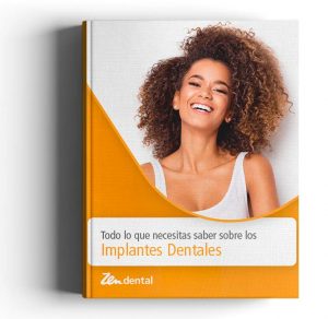 Todo lo que necesitas saber sobre los implantes dentales